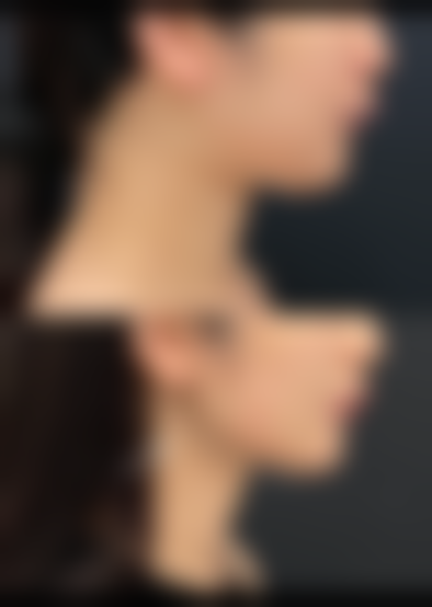 九、韩国李周赫KIESU整形外科医院真实的患者评价