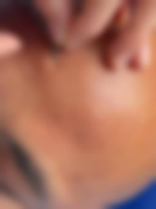 四、成都武侯檬悦医疗美容诊所特色项目