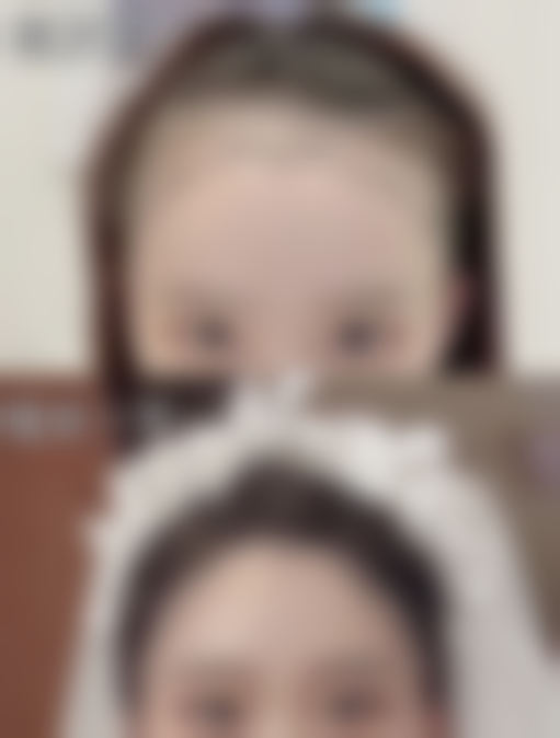 吸脂有什么危害吗？总结与建议