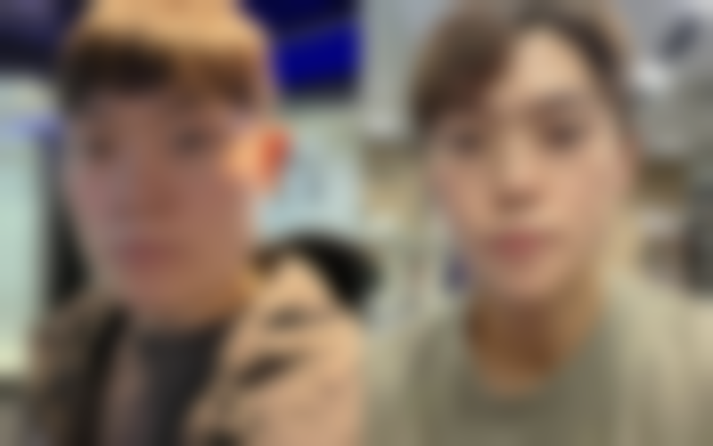 二、割了双眼皮一个月不宜化妆的情况