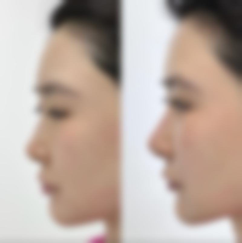 八、深圳睿科珑悦整形医院真实的患者评价