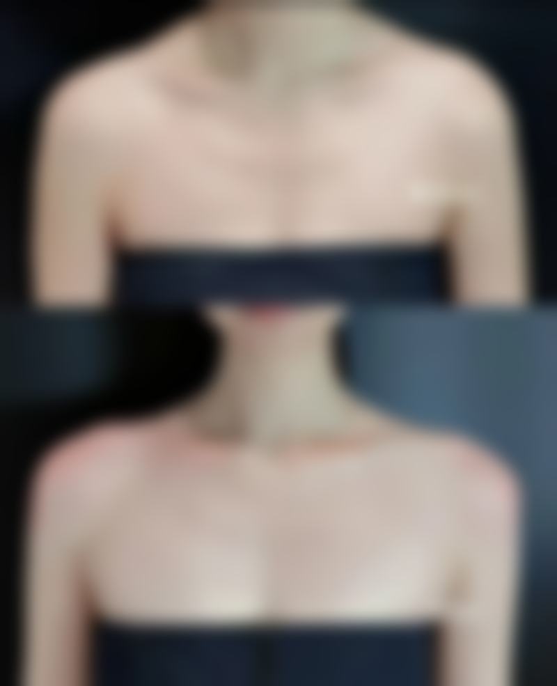 一、眼周肌肤问题现状