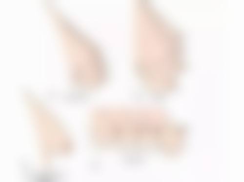 四、隆胸取出假体一般需要多长时间之术后护理要点