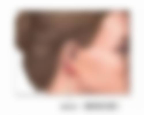 二、脸上磕伤了缝针的疤痕能否消除