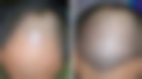 二、韩国NEWK整形医院怎么样？