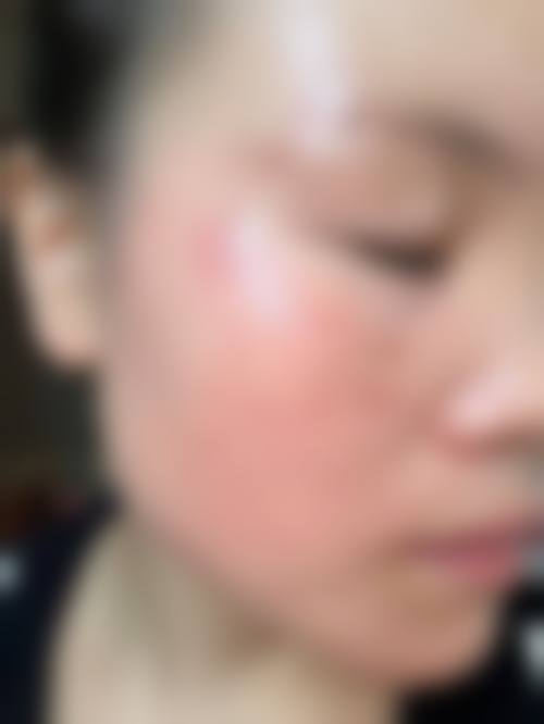 九、韩国NEWK整形医院真实的患者评价