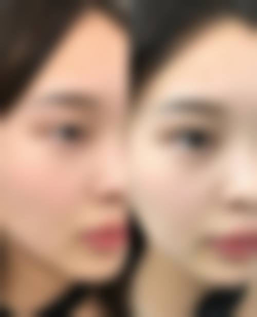 五、李新立怎么预约？