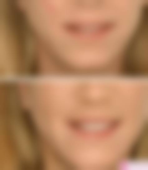 四、宁波江北尚美医疗美容门诊部特色项目