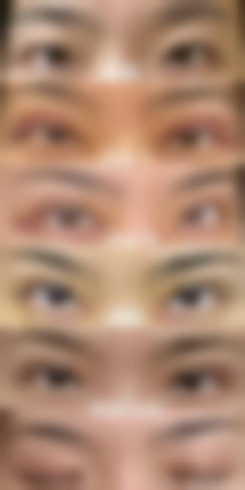 八、康定艾思汐整形医院真实的患者评价