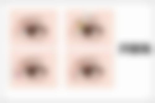 四、康定艾思汐整形医院特色项目