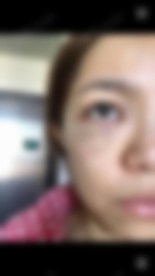 八、宁波江北尚美医疗美容门诊部真实的患者评价