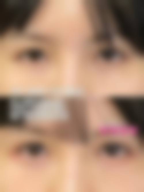 四、西安唯星颜医疗美容门诊部特色项目