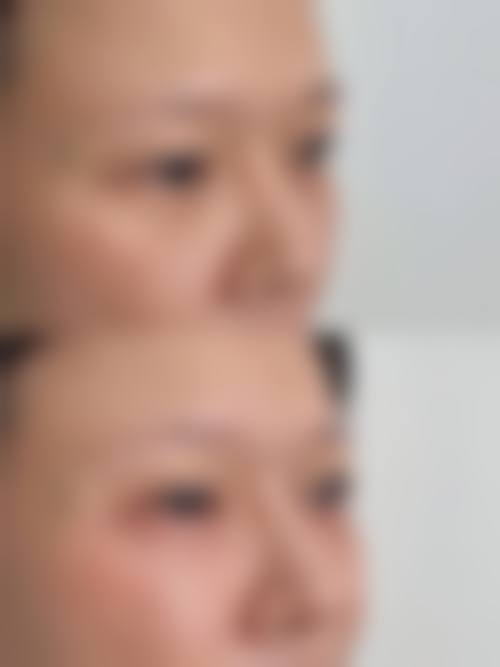 五、西安唯星颜医疗美容门诊部价格表