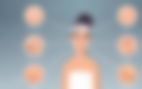 二、三点双眼皮手术的具体过程