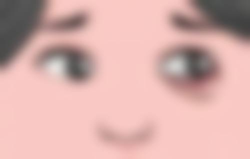 三、双眼皮不对称的修复方案