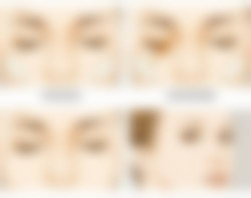 一、按摩去眼袋的理论基础