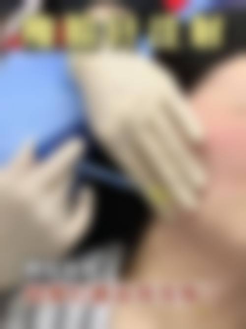 五、汪国应怎么预约？