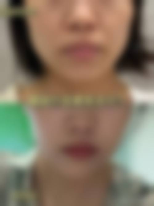 三、汪国应技术优势