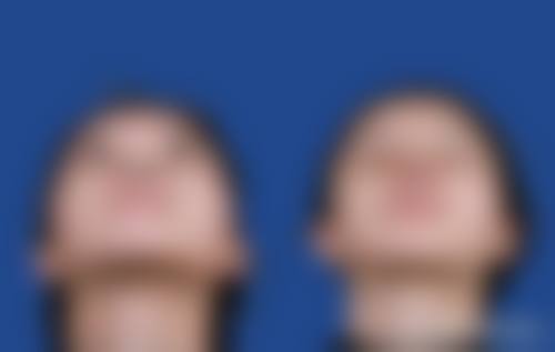 五、尹圣恩怎么预约？