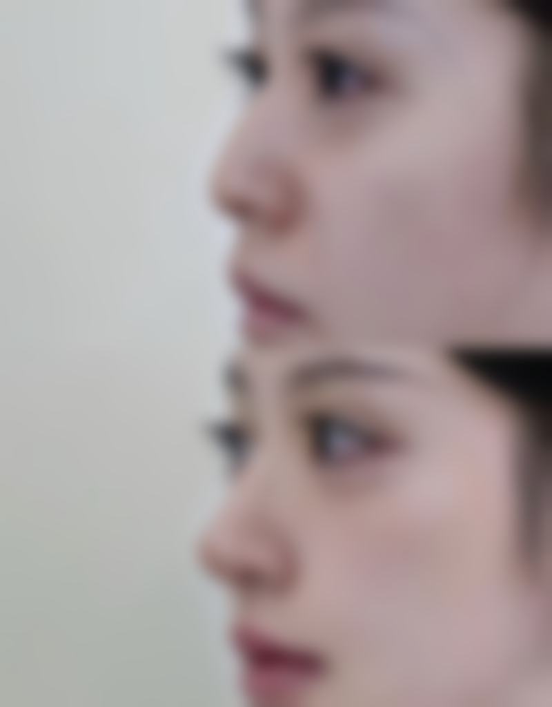 四、日本LiraCranio面部诊所特色项目