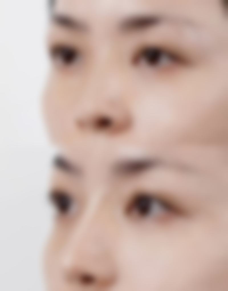 九、日本LiraCranio面部诊所真实的患者评价