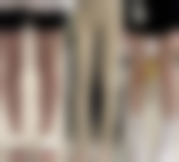 一、冷热敷交替，助力消肿修复