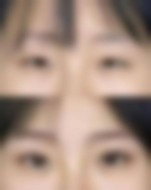 八、杭州静娇医疗美容整形医院真实的患者评价