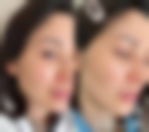 八、韩国 thebuty 整形外科真实的患者评价