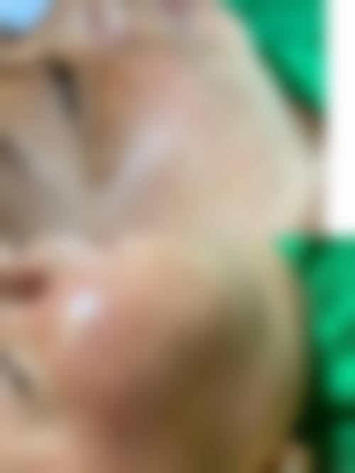 四、杭州静娇医疗美容整形医院特色项目