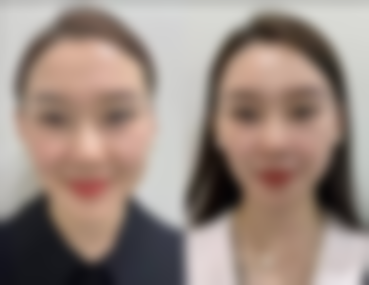 五、韩国 thebuty 整形外科价格表