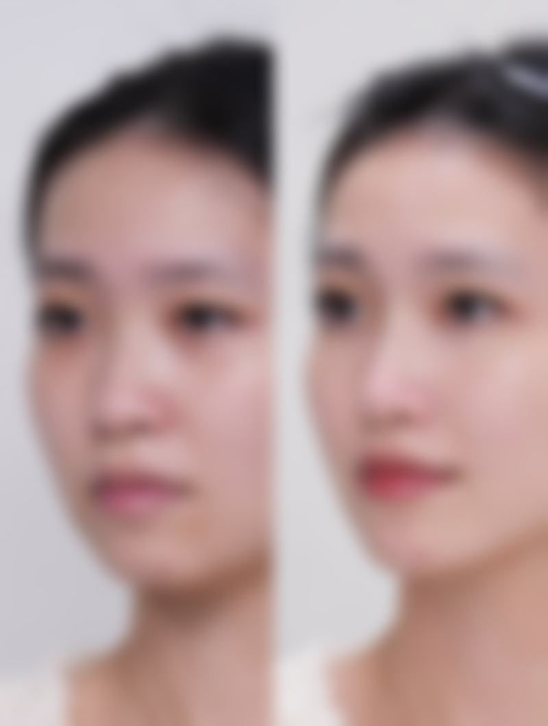 四、韩国 thebuty 整形外科特色项目