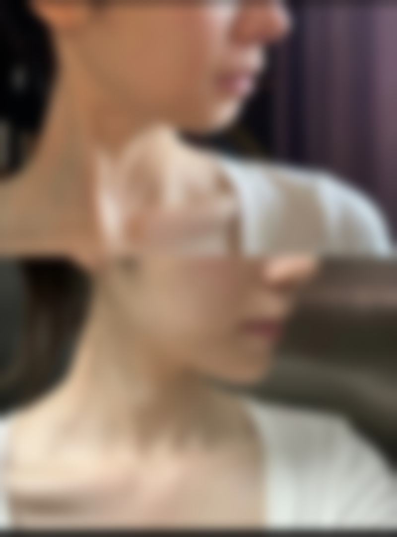 三、韩国TheOne整形医院诊疗项目有哪些？