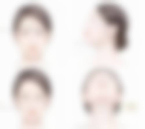 二、打了瘦脸针后怀孕了有影响吗——正常情况下的影响分析