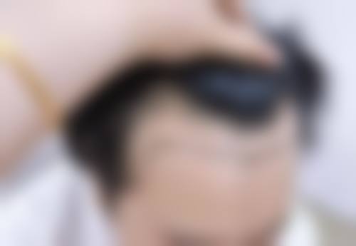 六、司博伟真实的患者评价