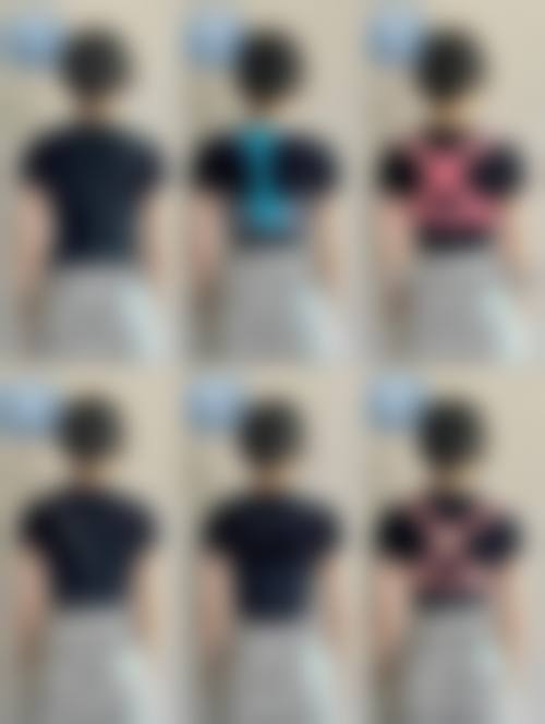 五、北京中德植发医院价格表