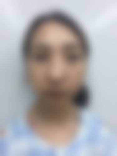 八、北京中德植发医院真实的患者评价