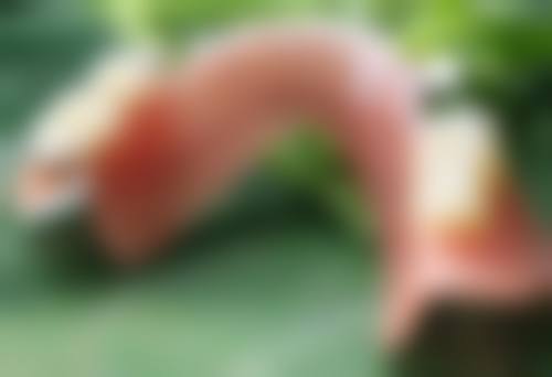 伤口缝针后如何不留疤痕？面部缝针后这些方法助你实现无痕愈合