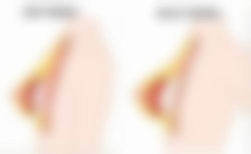 四、伤口缝针后如何不留疤痕之饮食调理