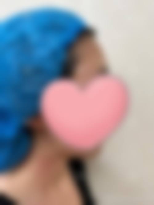 七、杭州苹佳瓒美医疗美容门诊部预约方式