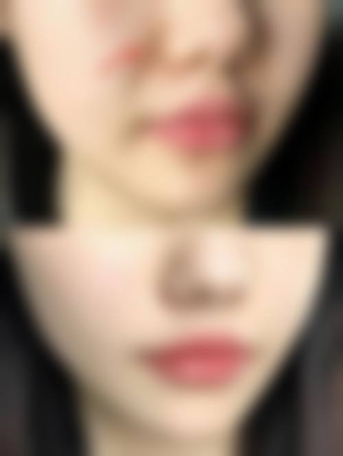 五、杭州苹佳瓒美医疗美容门诊部价格表