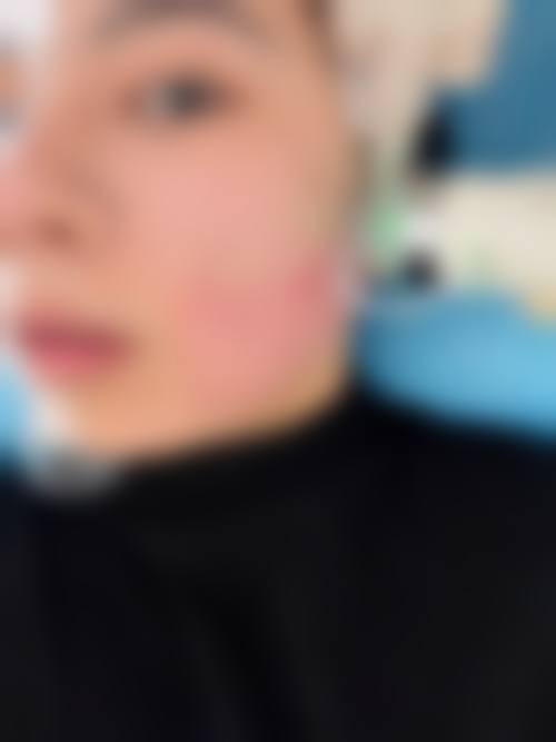 五、黄石第四 医院美容科价格表