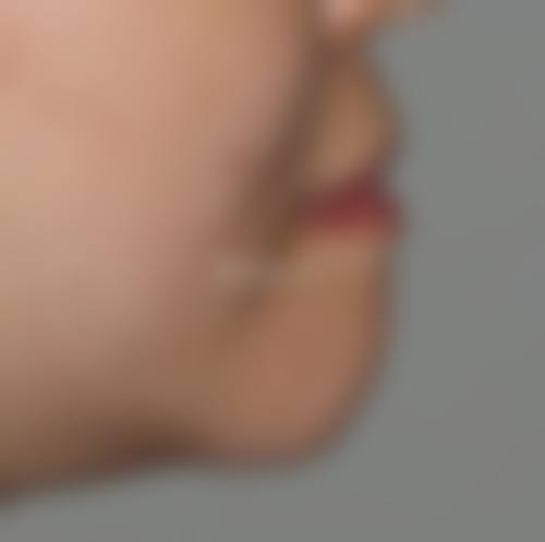 二、黄石第四 医院美容科怎么样？