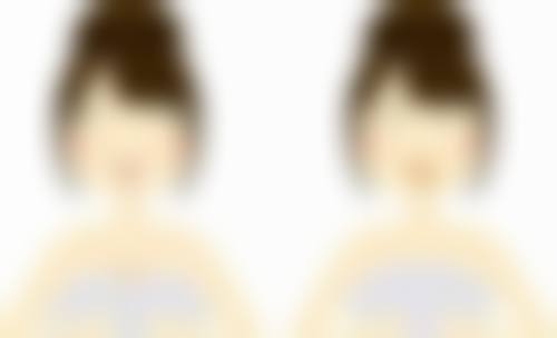 四、经期做双眼皮有影响吗？实例分析