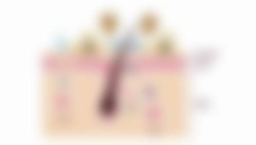 五、经期做双眼皮有影响吗？应对建议