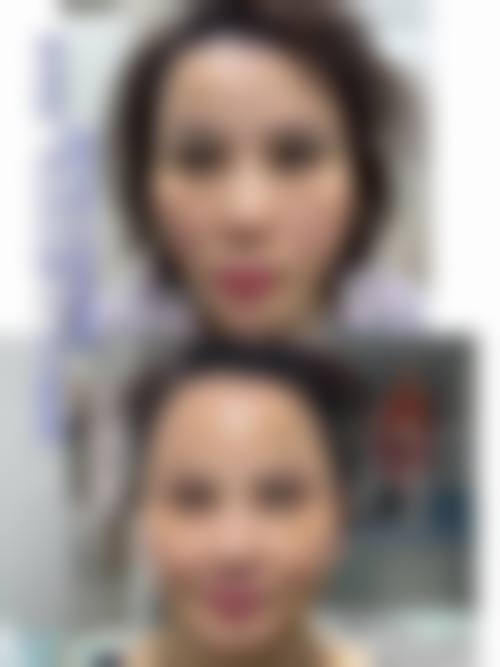 二、ES清潭医院怎么样？