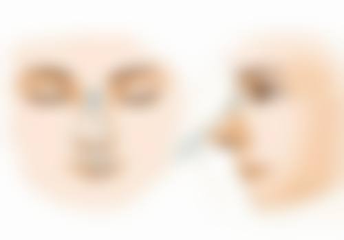 七、修复手术的风险与应对