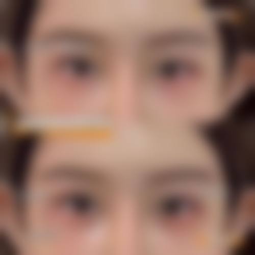 四、北京美联臣整形医院特色项目