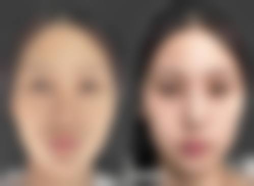 八、沈阳云惠美医疗美容预约方式