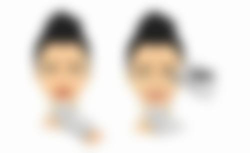 五、假体隆胸成效怎样：提升女性自信