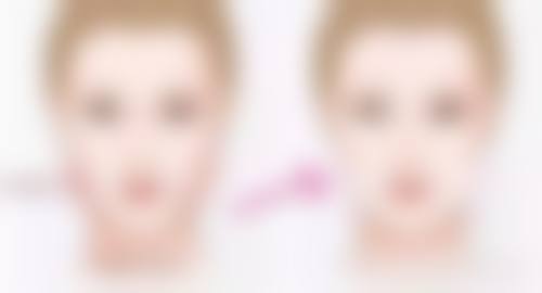 三、手术隆鼻是恒久的吗？不同隆鼻方式的大致费用